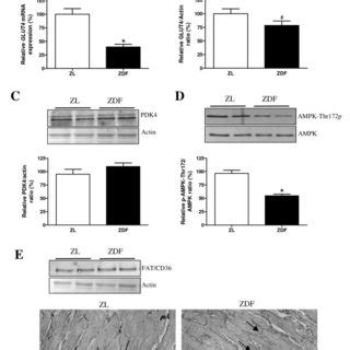 In Vivo Alterations In Myocardial Substrate Metabolism Myocardial