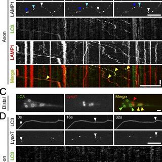 Autophagosomes Mature As They Move Distally To Proximally Along The