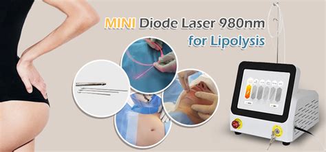 980nm Triangel Laser Endolift Lipolysis Machine Buy 980nm Endolift