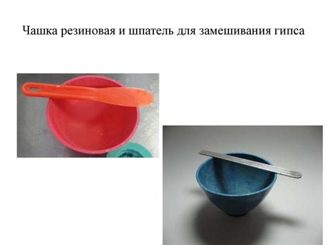 Изготовление гипсовых моделей в зубном протезировании - презентация онлайн