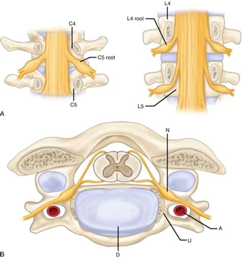 Cervical Radiculopathy Nerve Root Compression