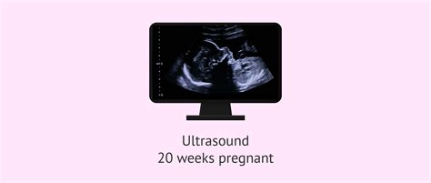 Ultrasound in the 20th week of pregnancy