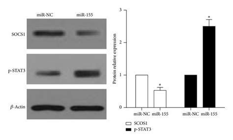 MiR 155 Regulated Directly SOCS1 STAT3 Signal Pathway A Schematic Of