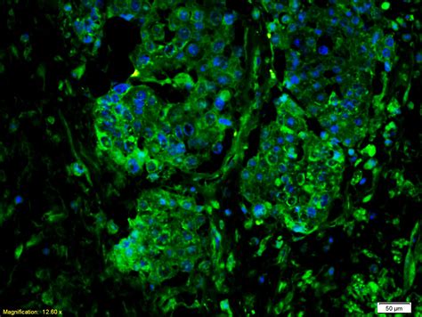 Il 6r Betacd130gp130 Antibody Bioss