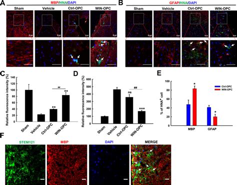 Win Induced Opcs Mostly Differentiated Into Mature Ols In The Lesion
