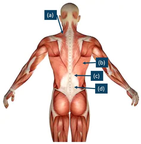 Ijerph Free Full Text Electromyographic Analysis Of Paraspinal Muscles Of Scoliosis Patients