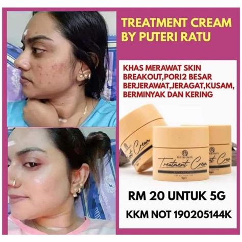 Puteri Ratu Magic Day Cream Testimoni Jual Krim Siang Puteri Ratu Magic Day Cream Original