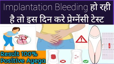 Implantation Bleeding Ke Baad Is Din Karna Chahiye Pregnancy Test