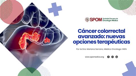 C Ncer Colorrectal Avanzado Nuevas Opciones Terap Uticas Spom