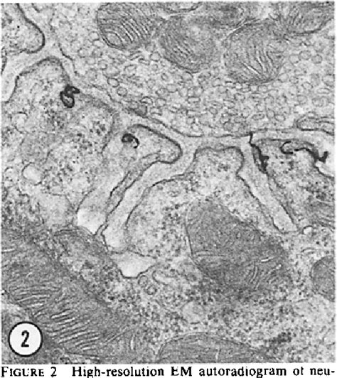 Figure From Quantitation Of Junctional And Extrajunctional