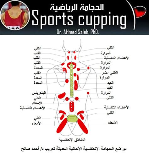 Sports Cupping الحجامة الرياضية مواضع الحجامة الالماني حديثة German