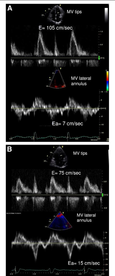 Figure 1 From The Role Of Multimodality Cardiac Imaging In The