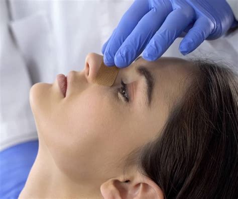 À éviter après une rhinoplastie du nez cassé Dr Liwarek Paris