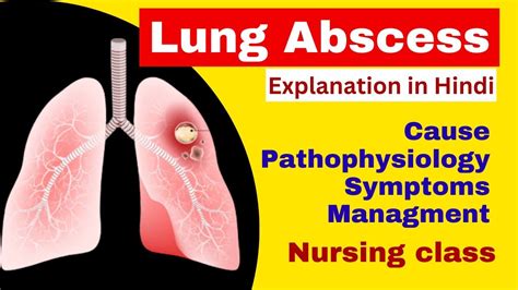 Lung Abscess Pathology In Hindi Cause Pathophysiology Symptoms Management Lung Abscess