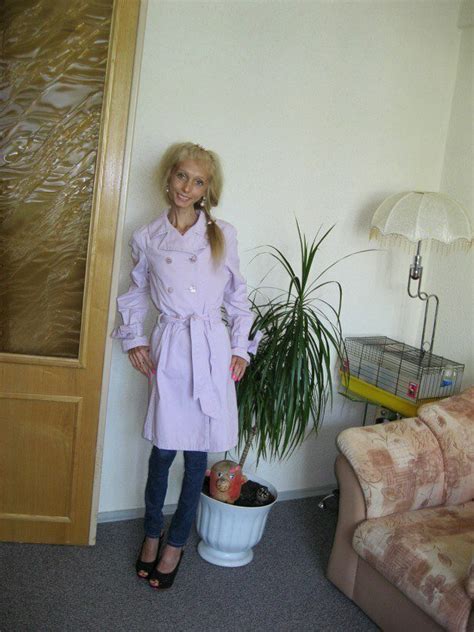 Jak dziś wygląda Ksenia Bubenko, która ważyła zaledwie 23 kilogramy ...