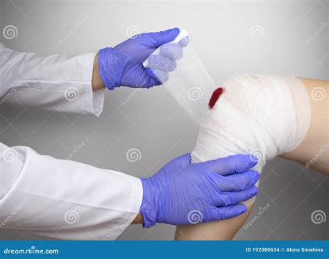 The Doctor Bandages The Knee Of A Girl Who Is Injured Stopping