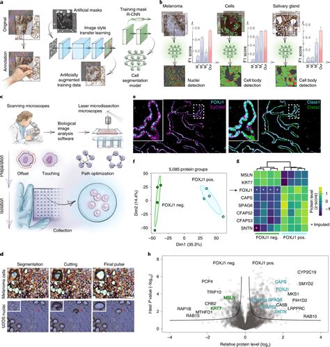 Deep Visual Proteomics Is Redefining Cancer Diagnostics
