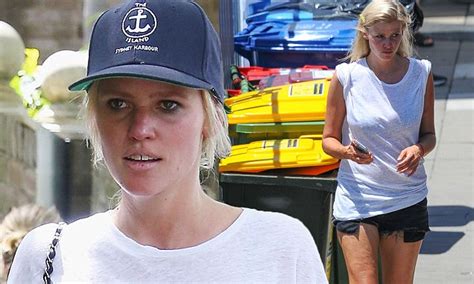 Lara Stone Shows Off Her Sunburnt Face As She Goes Shopping In Sydney