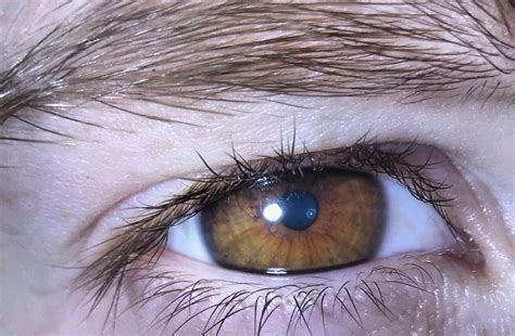 Beauty Of The Eye Colour Photo Georgia Republic