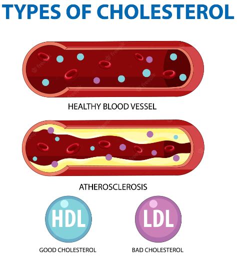 Cholesterol How It Impacts Your Heart Steven Masley Md Llc