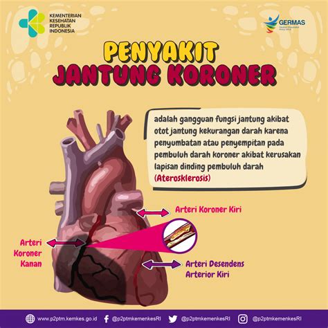 Apa Itu Penyakit Jantung Koroner Penyakit Tidak Menular Indonesia