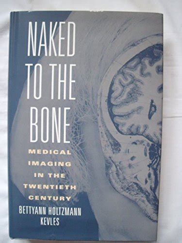 Naked To The Bone Medical Imaging In The Twentieth Century By Bettyann