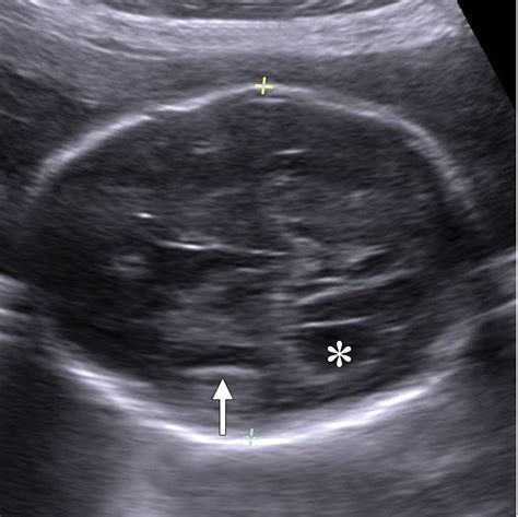 A Radiologists Guide To The Performance And Interpretation Of