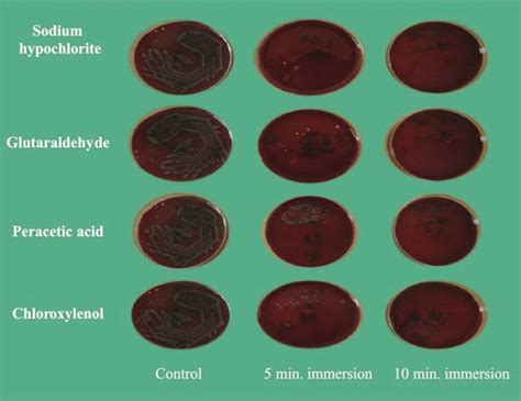 Blood Agar Plates Showing CFU For E Coli After 5 And 10 Minutes