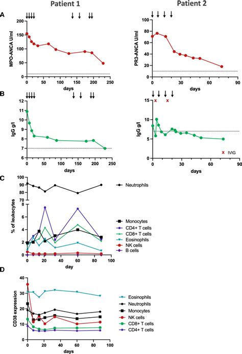 Daratumumab For The Treatment Of Refractory ANCA Associated Vasculitis