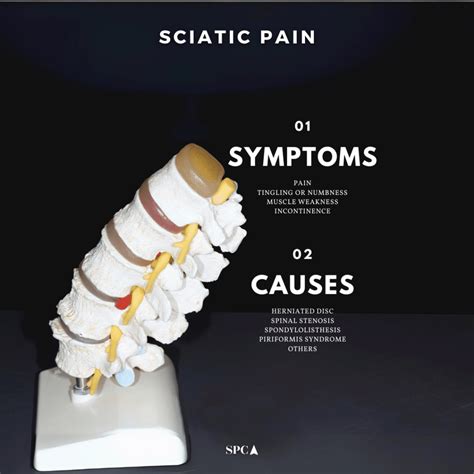 Sciatica Pain Treatment Sydney Sydney Pain Clinic