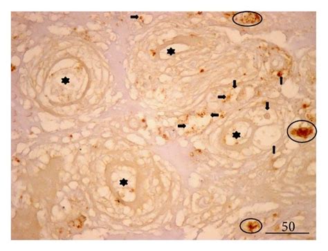 Testosterone Expression In Situ A Control Biopsy Larger Or Smaller