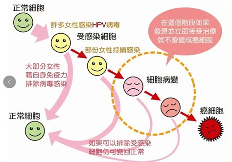 感染hpv有什么症状？身上一处长疙瘩，你或已感染了hpv阳性腾讯新闻