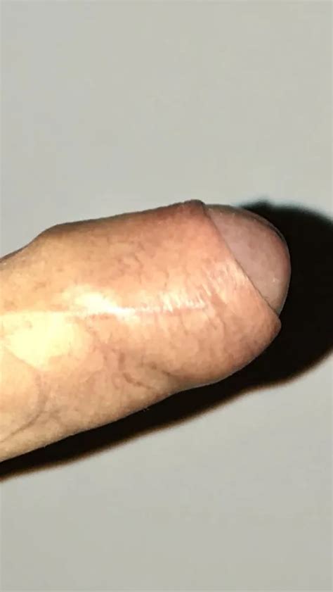 Big Cock Head 22 Nude Pics XHamster