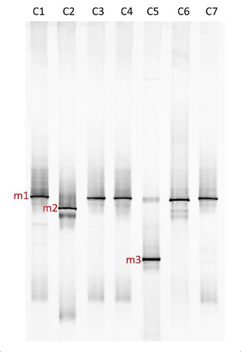 Polymerase Chain Reaction Dgge Profile Of 16s Rrna Gene Fragments Download Scientific