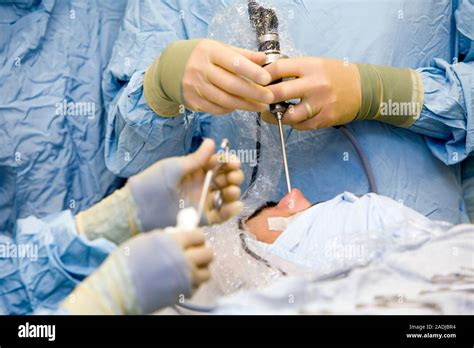 Sinus Surgery Surgeons Using An Endoscope Upper Centre During