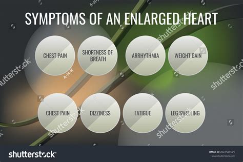 Symptoms Enlarged Heart Vector Illustration Medical Stock Vector Royalty Free 2022586529