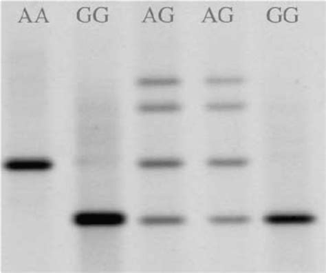 Denaturing Gradient Gel Electrophoresis Banding Patterns For The