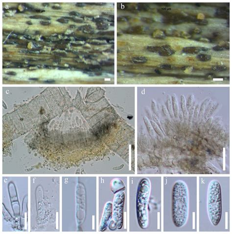 Colletotrichum Dracaenophilum Facesoffungi Number FoF 10776 Faces