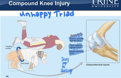 Clinical Anatomy Exam Flashcards Quizlet