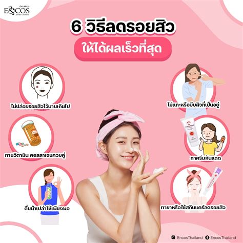 6 วิธี รักษาและลดรอยสิวให้เห็นผลเร่งด่วน รอยสิวหาย หน้าใสขึ้น Eandcos Thailand