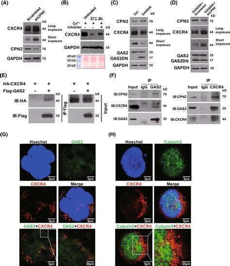 Gas Silencing Impairs Notch C Myc Signaling In T All Cells A