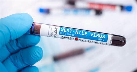 West Nile: sintomi, diagnosi e come riconoscerla | Il Bo Live
