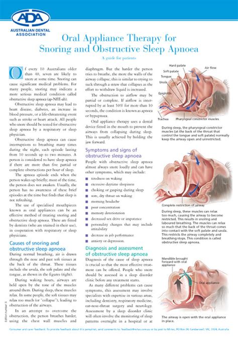 Oral Appliance Therapy For Snoring And Obstructive Sleep Apnoea Mi