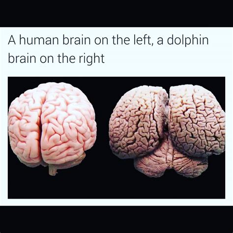 Human Brain vs Dolphins Brain | MedicosPlexus