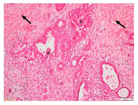 Ijms Free Full Text Targeting Hgf C Met Axis In Pancreatic Cancer