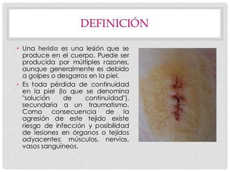 Clasificación De Heridas Y Su Tratamiento