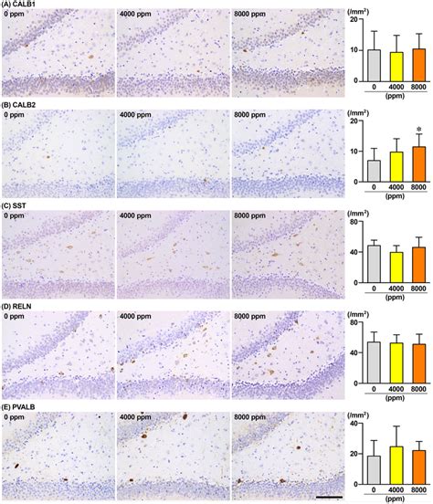 Distribution Of Immunoreactive Cells For A Calbindin D 28k Calb1 B Download Scientific