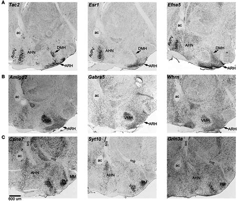 Expression Of Sexually Dimorphic Transcripts In The Hypothalamus