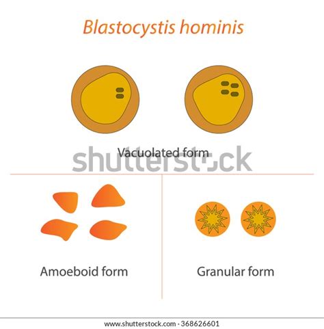 Vektor Stok Blastocystis Hominis Parasitic Microscope Tanpa Royalti