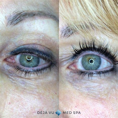 Lash Lift - Deja Vu Med Spa - Lash Lift Near Me Treatment